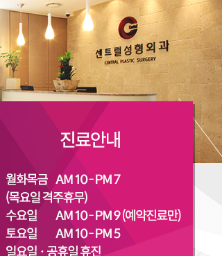 센트럴성형외과 상담 및 예약