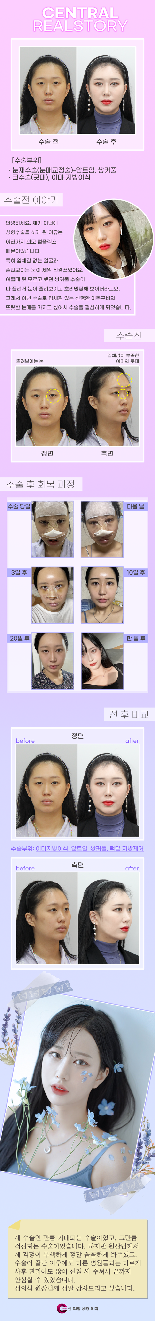 센트럴성형외과 
