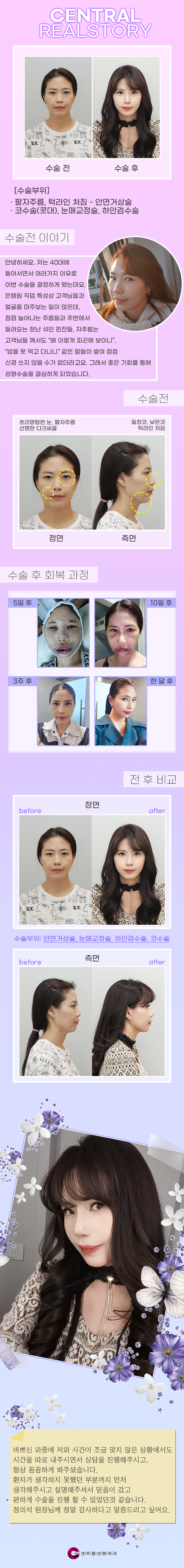 센트럴성형외과 