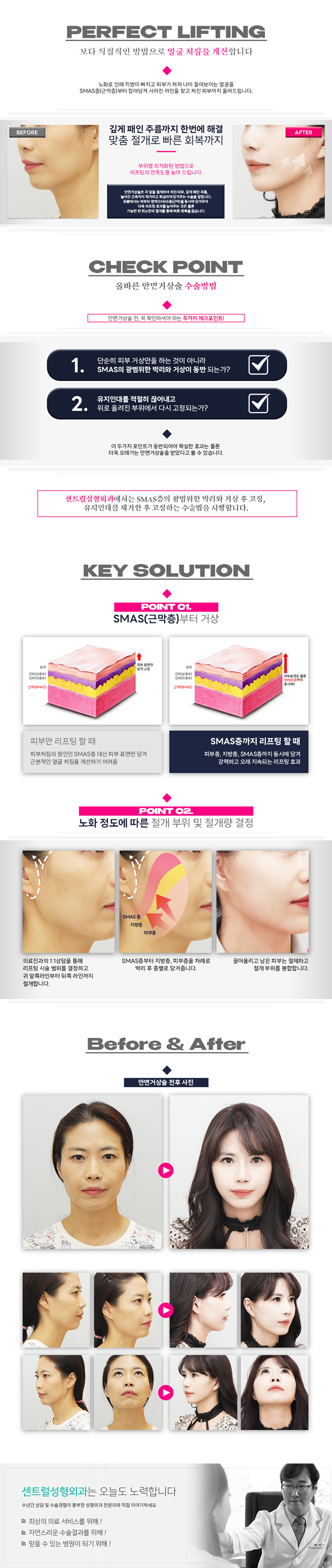 센트럴성형외과 
