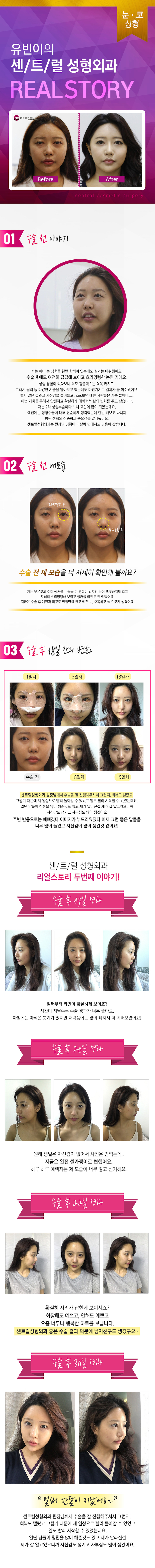 센트럴성형외과 