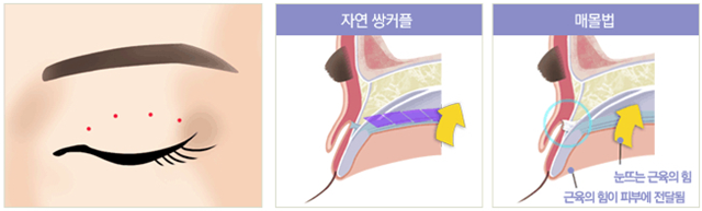 센트럴성형외과 