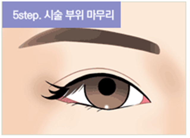 센트럴성형외과 