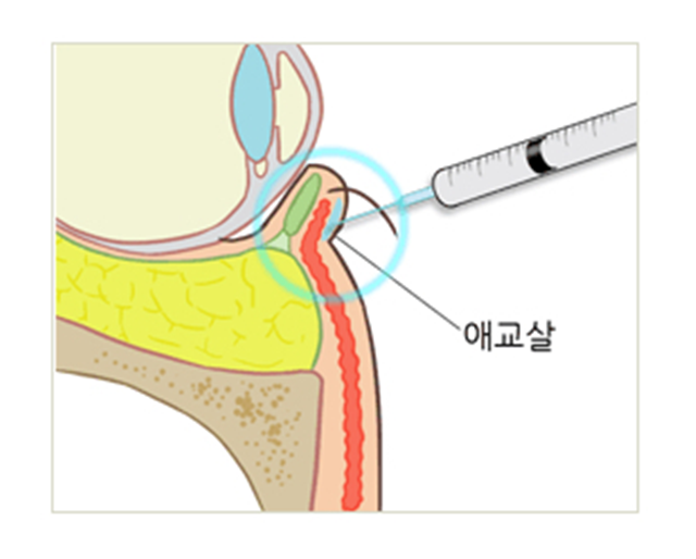 센트럴성형외과 
