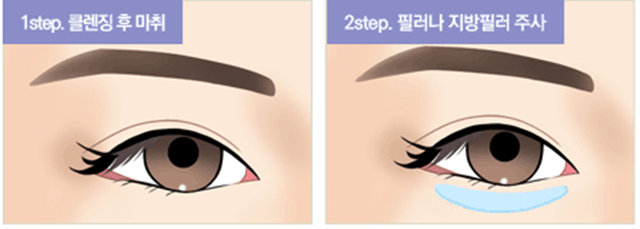 센트럴성형외과 