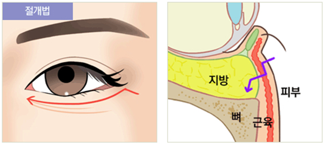 센트럴성형외과 