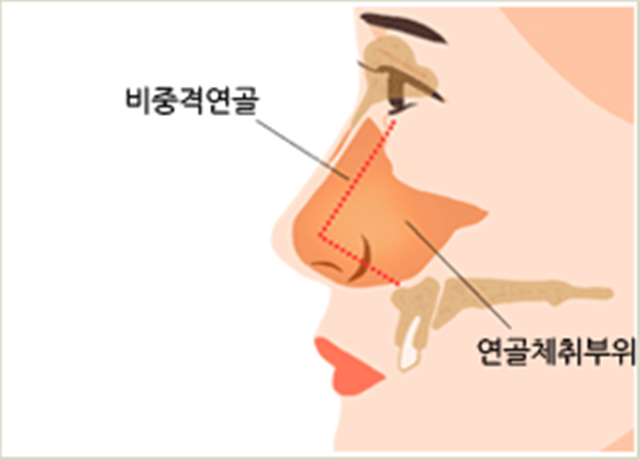 센트럴성형외과 