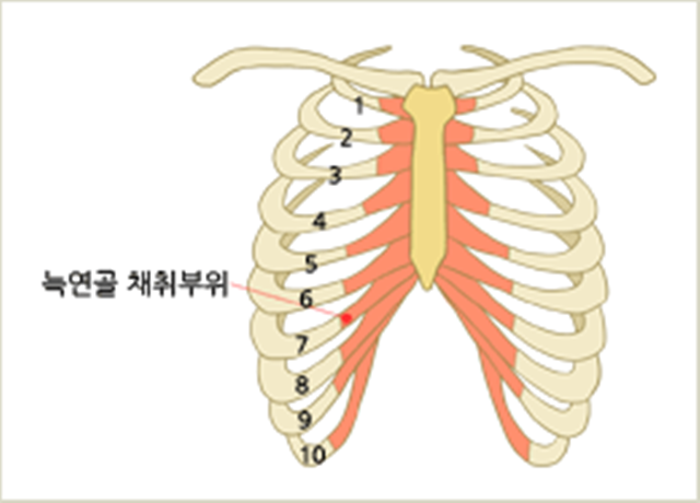 센트럴성형외과 