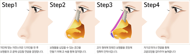 센트럴성형외과 