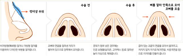 센트럴성형외과 
