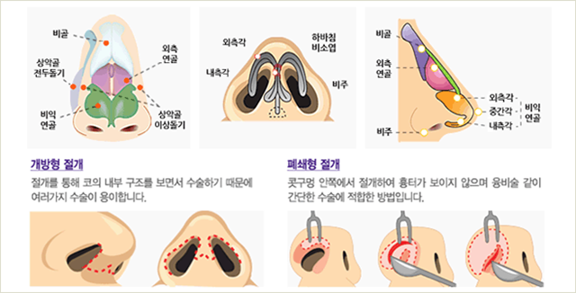 센트럴성형외과 
