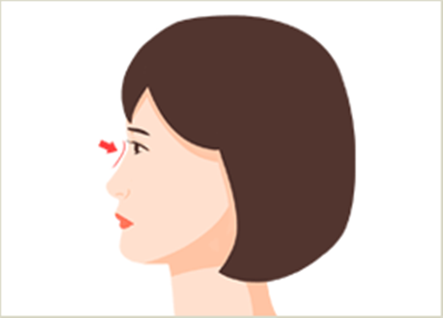 센트럴성형외과 