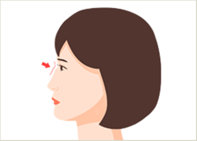 센트럴성형외과 