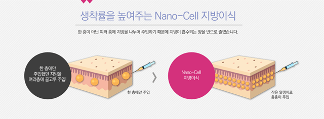센트럴성형외과 