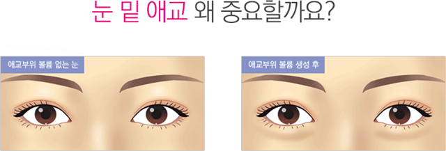 센트럴성형외과 