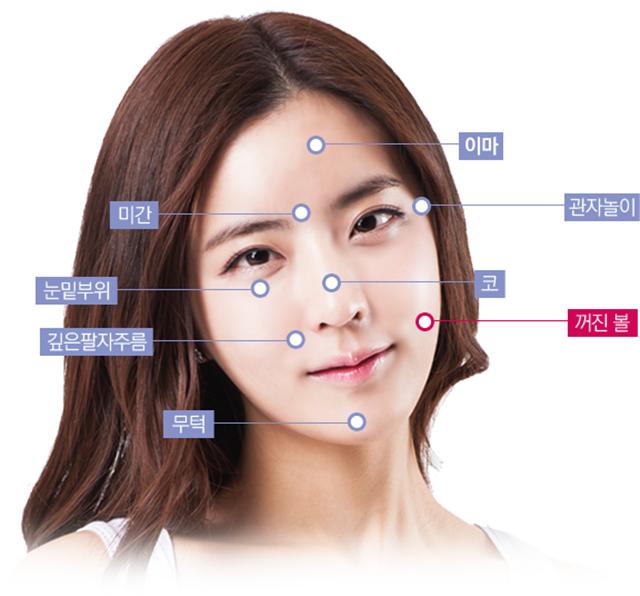 센트럴성형외과 