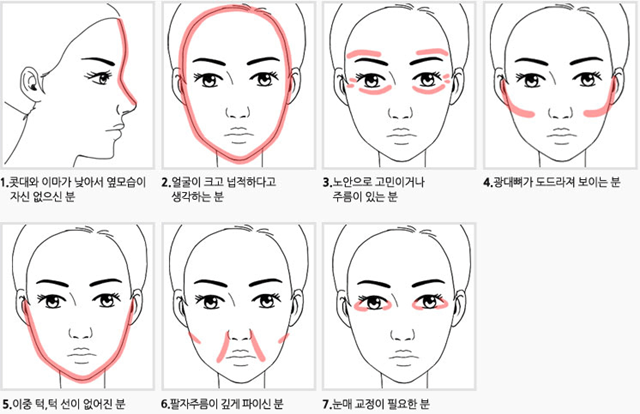 센트럴성형외과 