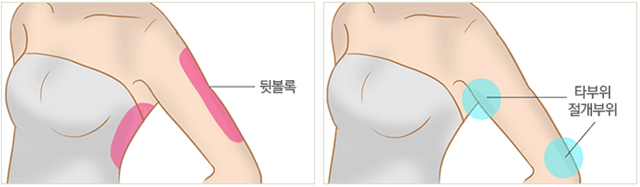 센트럴성형외과 