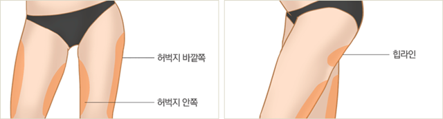 센트럴성형외과 
