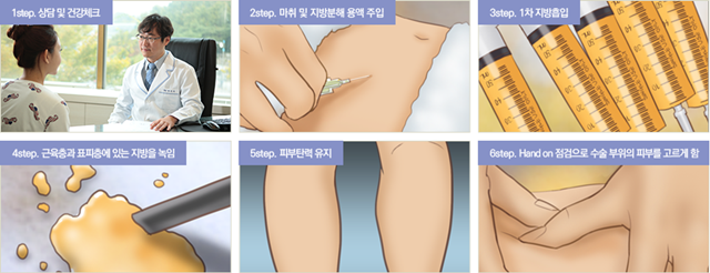 센트럴성형외과 