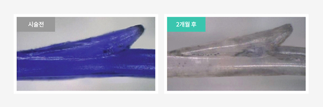 센트럴성형외과 