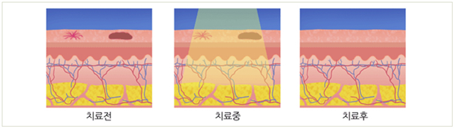 센트럴성형외과 
