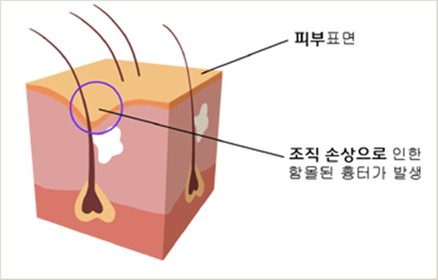 센트럴성형외과 