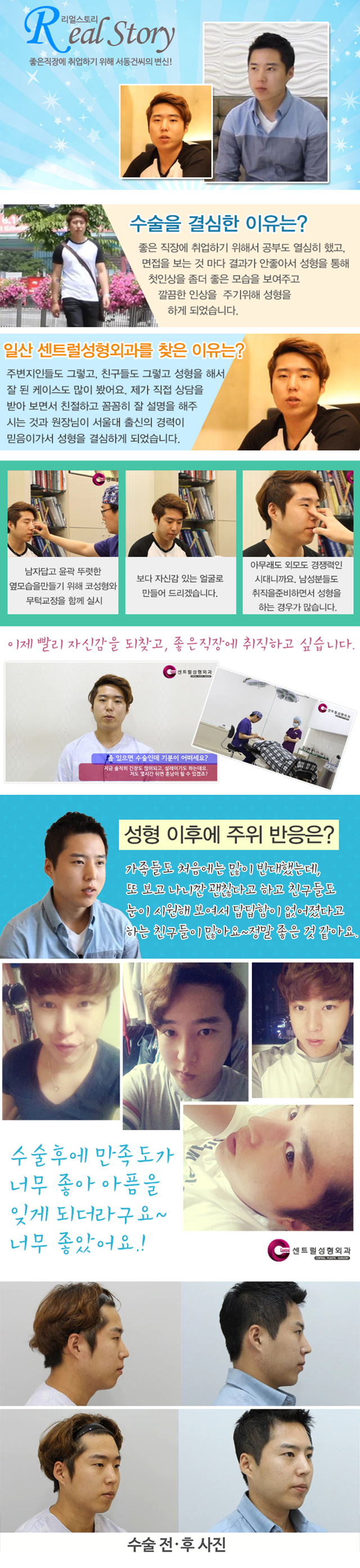 센트럴성형외과 