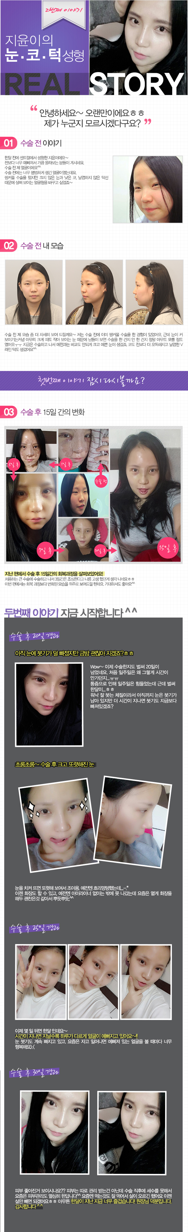 센트럴성형외과 