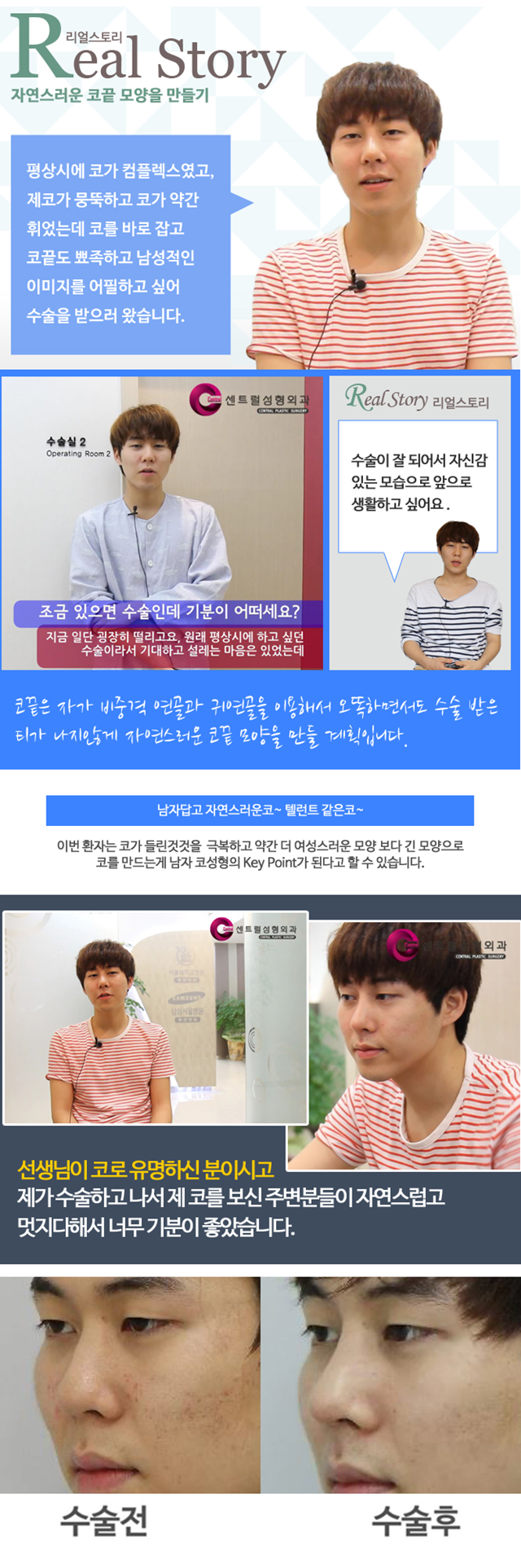 센트럴성형외과 