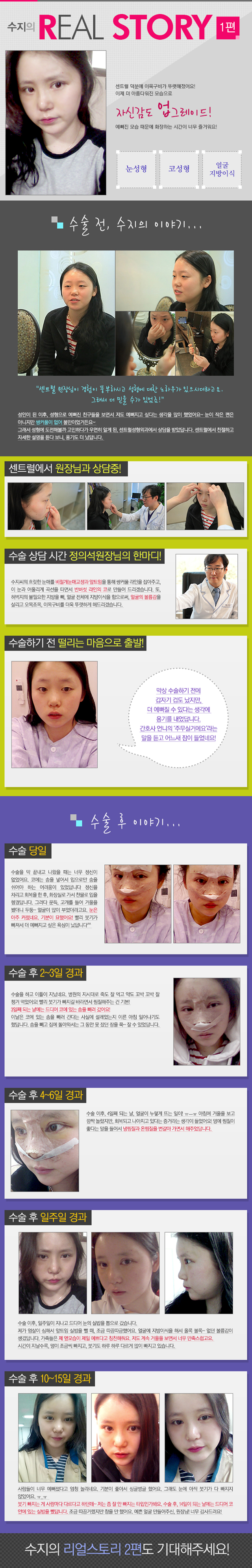 센트럴성형외과 