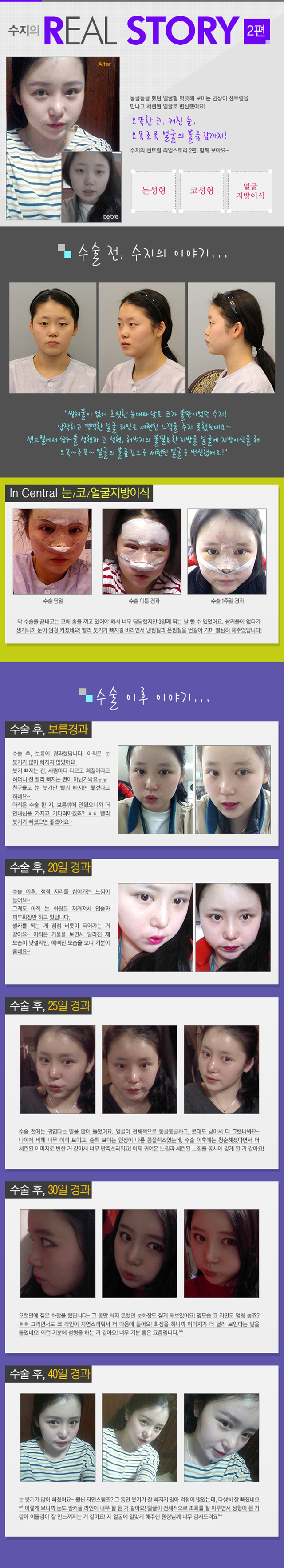 센트럴성형외과 