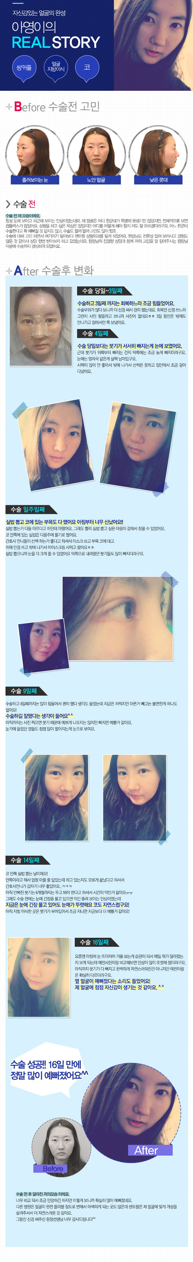 센트럴성형외과 