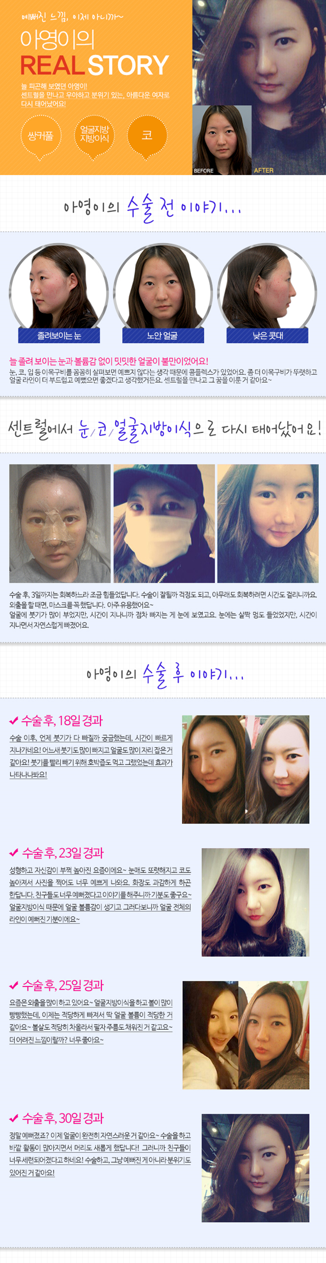 센트럴성형외과 