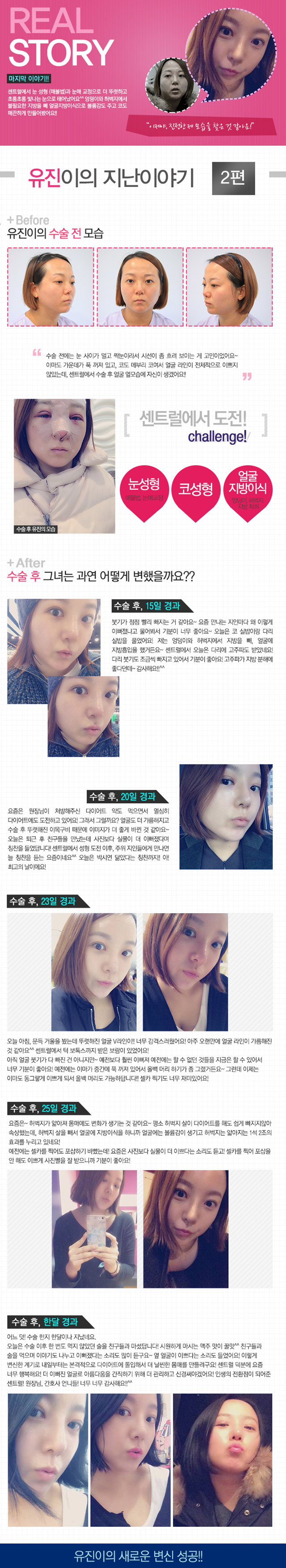 센트럴성형외과 