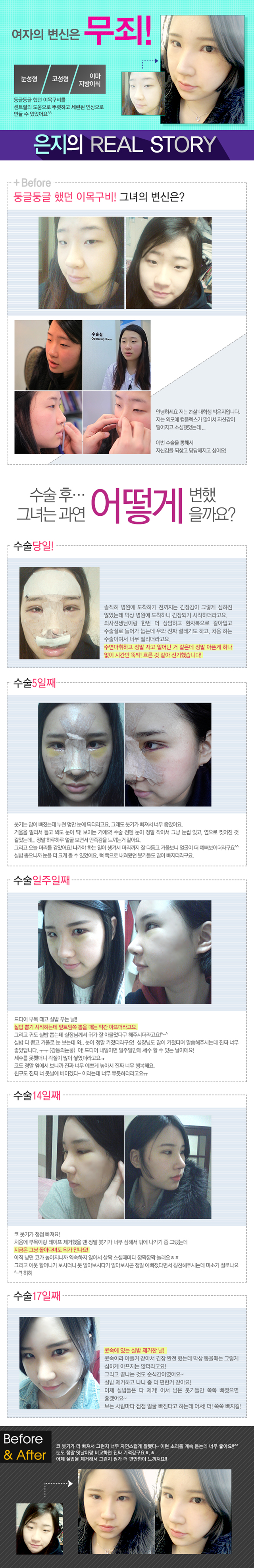 센트럴성형외과 