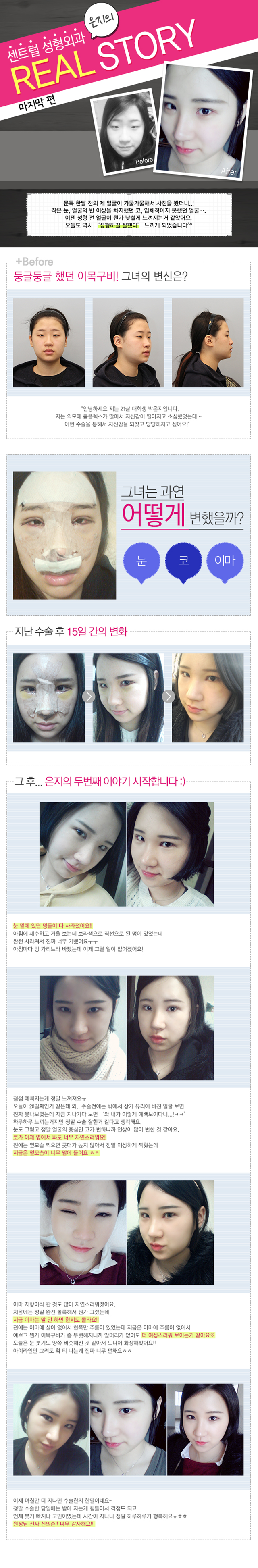 센트럴성형외과 